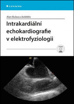 Intrakardiální echokardiografie v elektrofyziologii